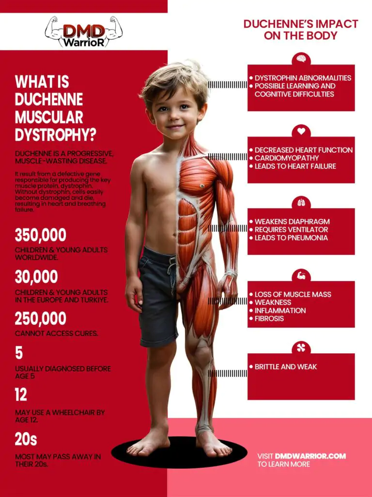 What Is Duchenne Muscular Dystrophy? Symptoms, Treatment & Life
