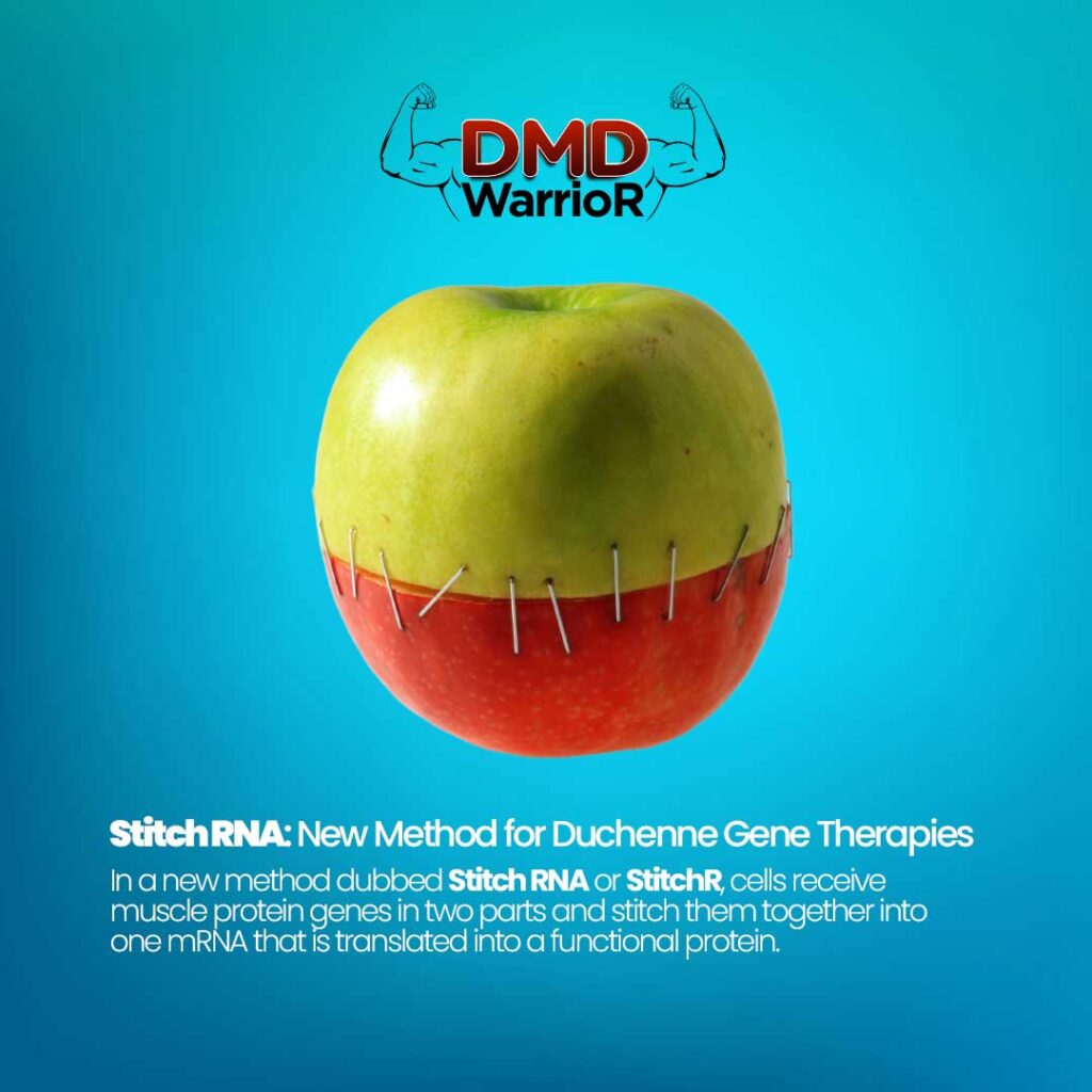 The Stitch RNA (StitchR) method could accelerate the development of new drugs that could significantly treat Duchenne Muscular Dystrophy.