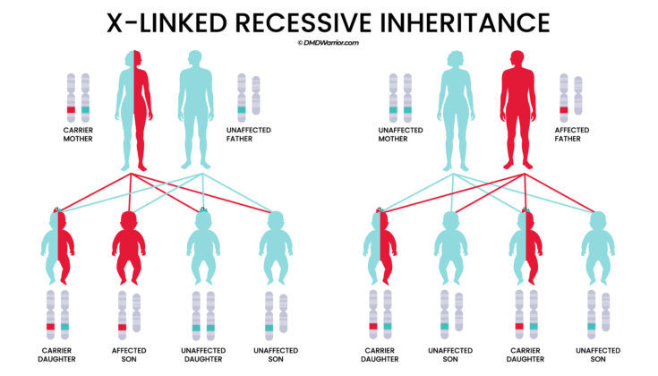 Prenatal Testing for Duchenne Muscular Dystrophy (DMD) - DMD Warrior