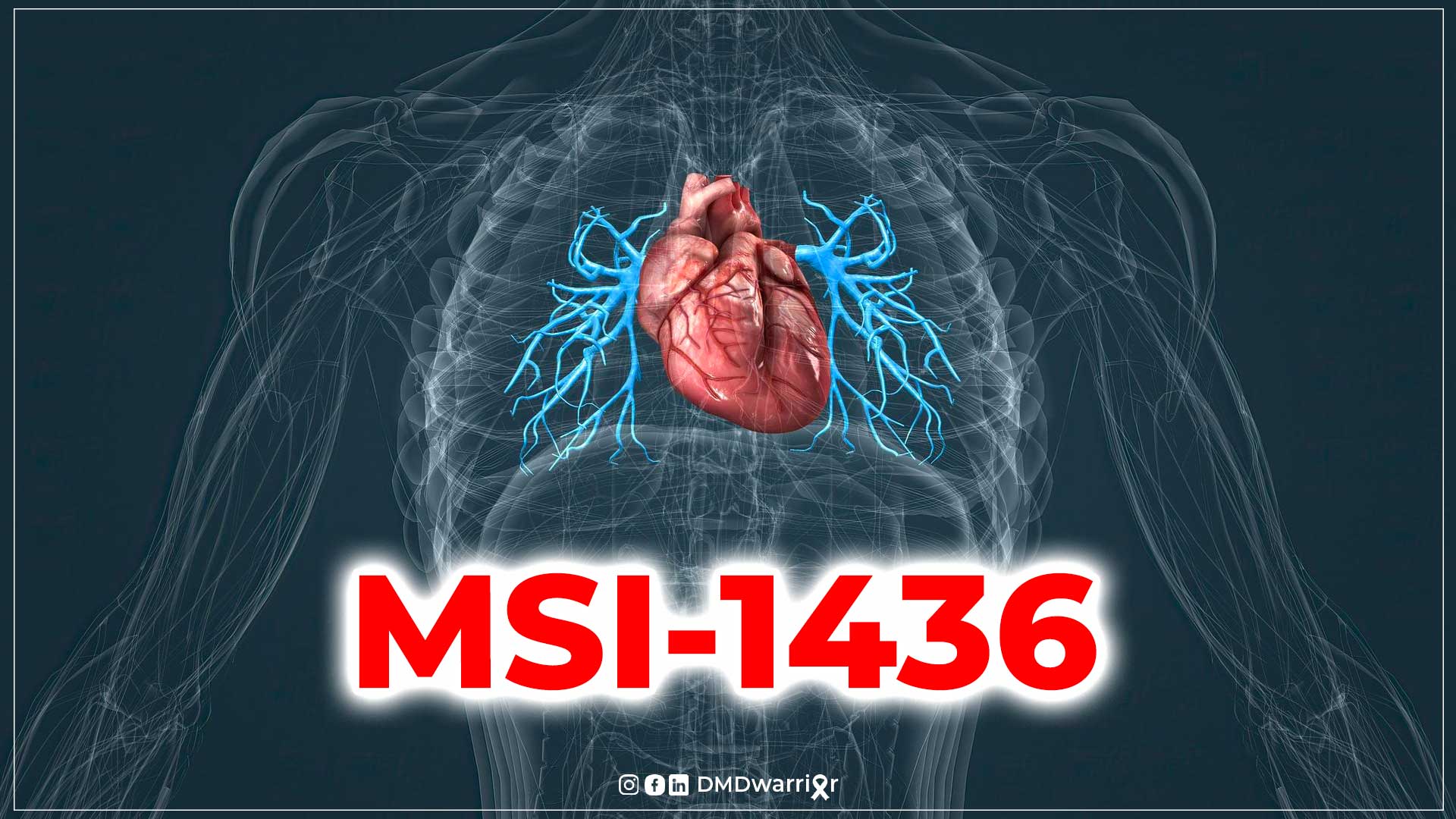 Revidia Therapeutics MSI-1436有望治疗杜氏肌营养不良症（DMD）患者的心力衰竭