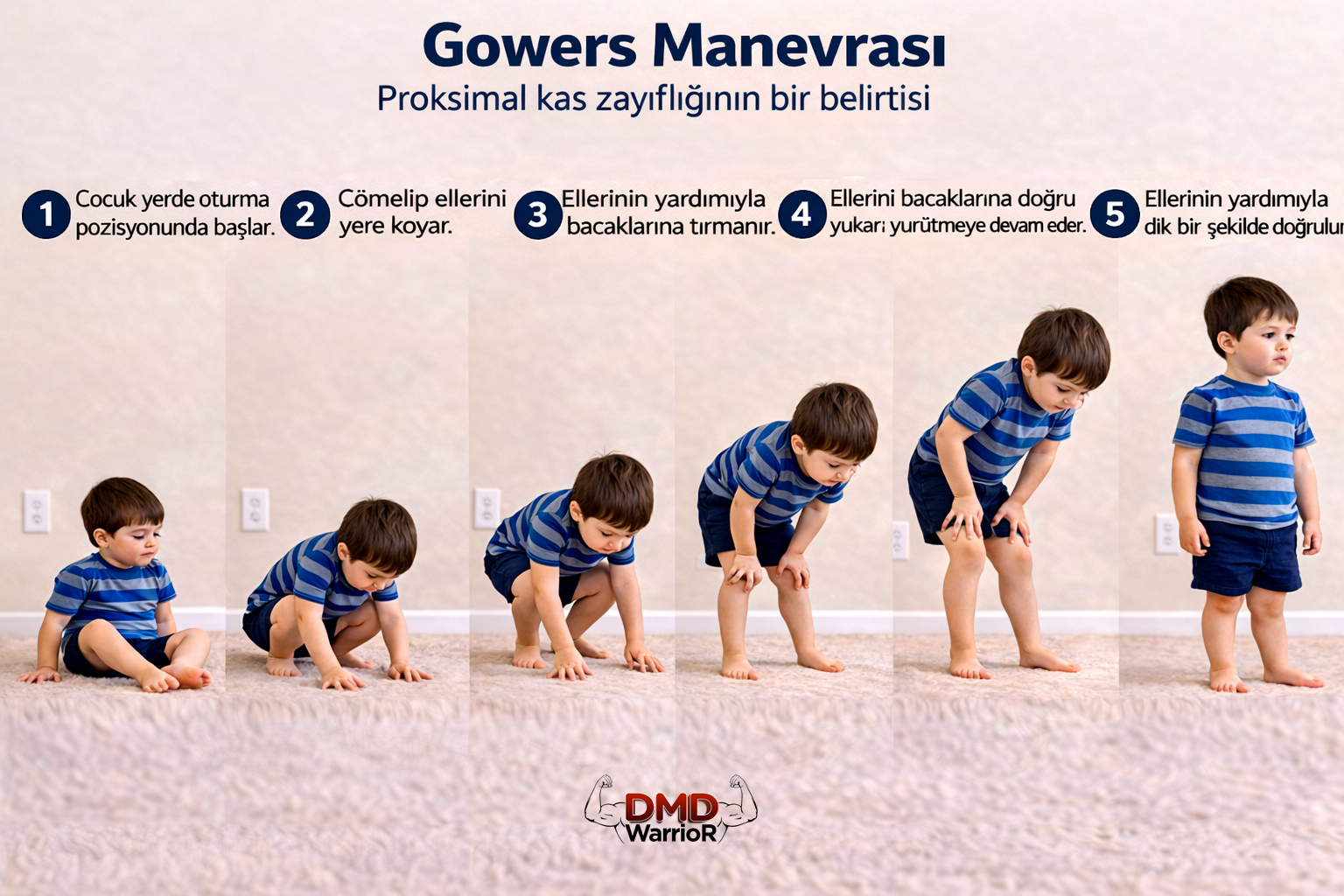 Duchenne Kas Distrofisinin Her Ebeveynin Bugün Bilmesi Gereken 6 Erken Belirtisi 1 Gowers Manevrası: Duchenne Kas Distrofisinin Erken Belirtileri